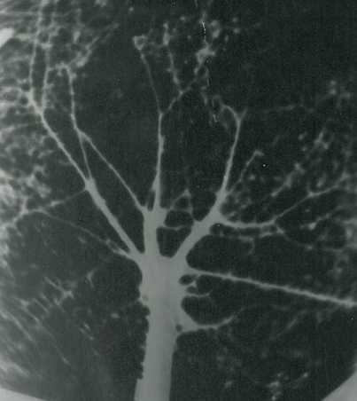 A tree negative produce on a pinhole camera